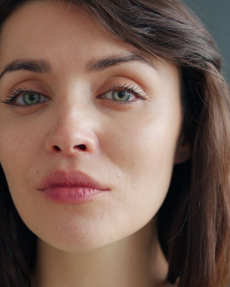 Signature Facial — before